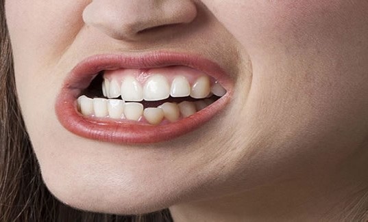 علل بروز درد دندان پس از درمان ریشه (عصب کشی)